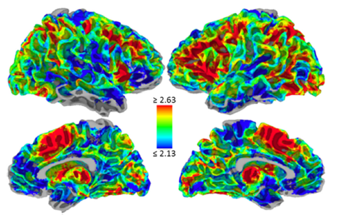 Pessoa brain image